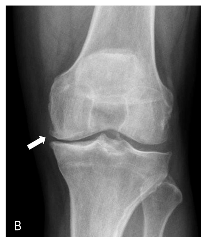 Figure 1B