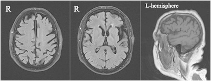 Figure 4