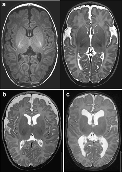 Fig. 5