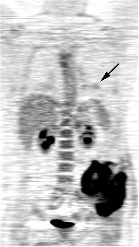 Fig. 1-A