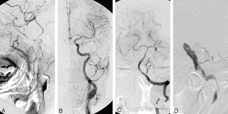 Fig 2.