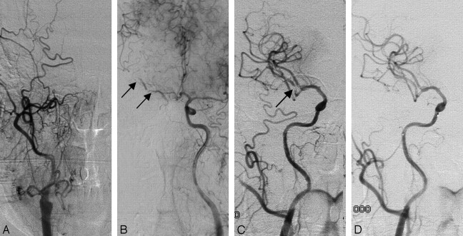 Fig 1.