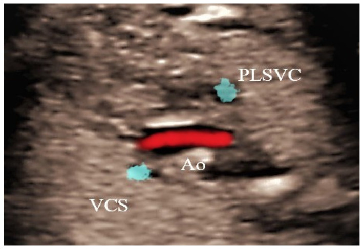 Figure 5