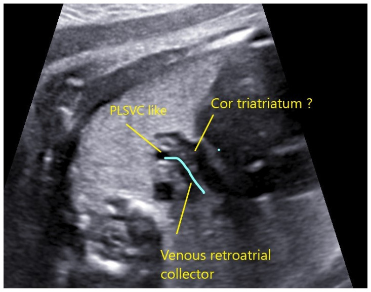 Figure 17