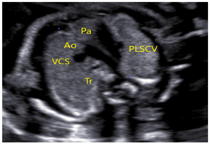 Figure 14