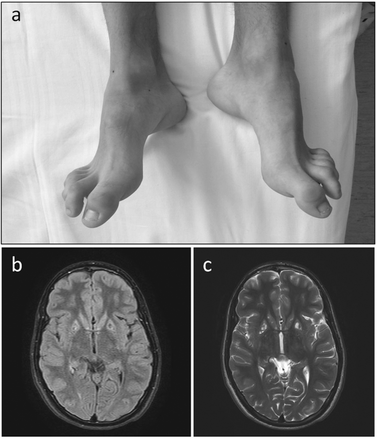 Fig. 1