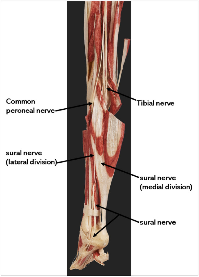 Fig. 1