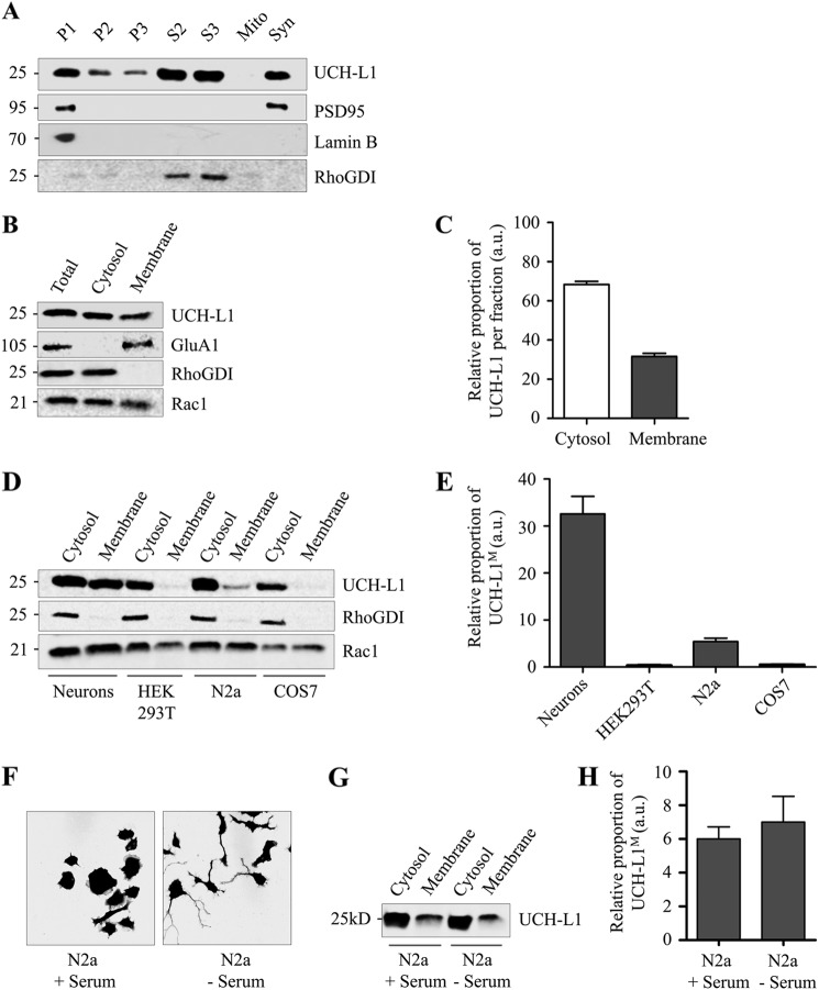 The Ubiquitin C-Terminal Hydrolase L1 (UCH-L1) C Terminus Plays a Key ...