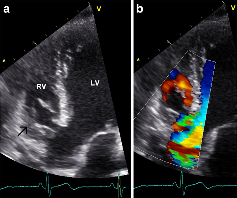 Fig. 2