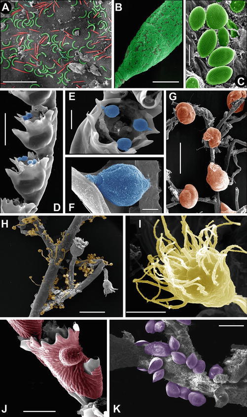 Hydroids (Cnidaria, Hydrozoa): A Neglected Component of Animal Forests ...