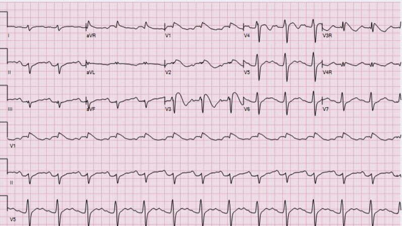 Figure 1