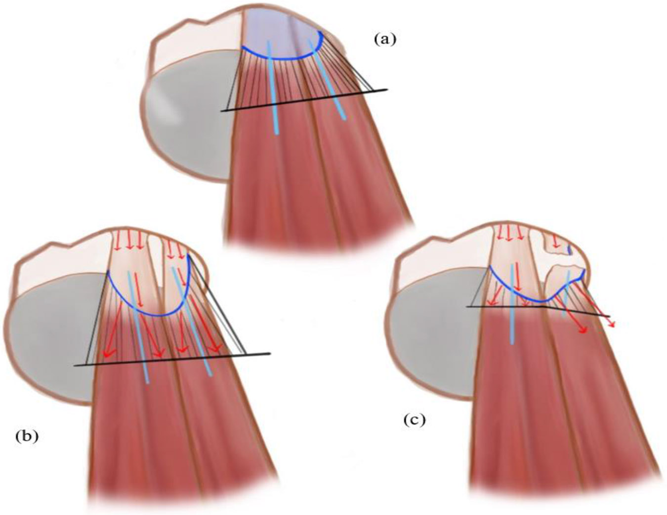 Figure 5: