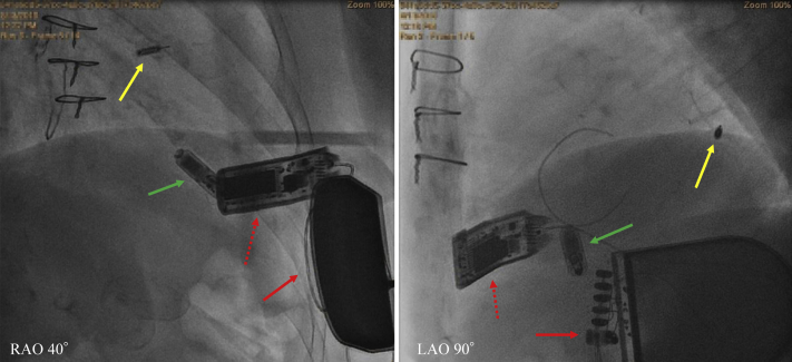 Figure 3