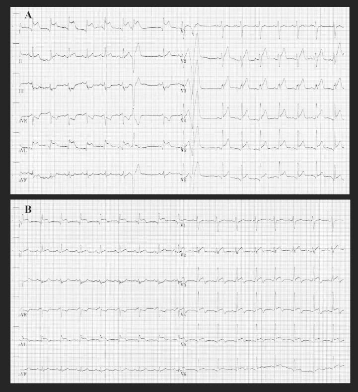 Fig.1