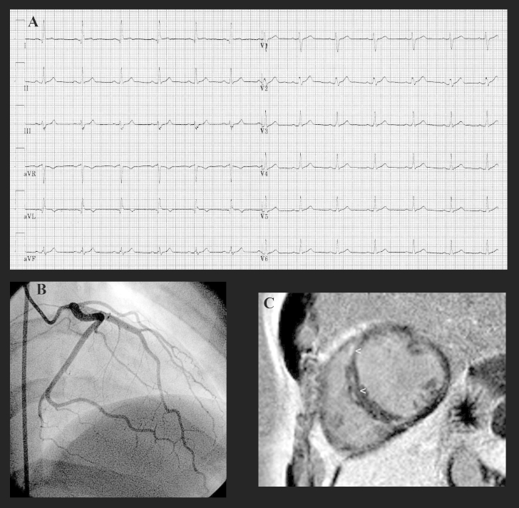 Fig.2