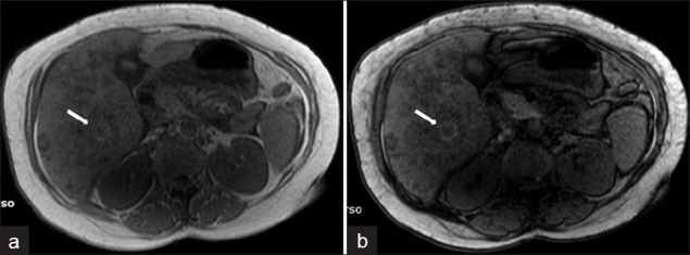 Figure 16