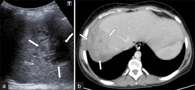 Figure 15