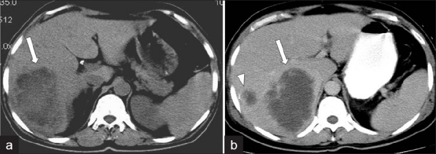 Figure 17