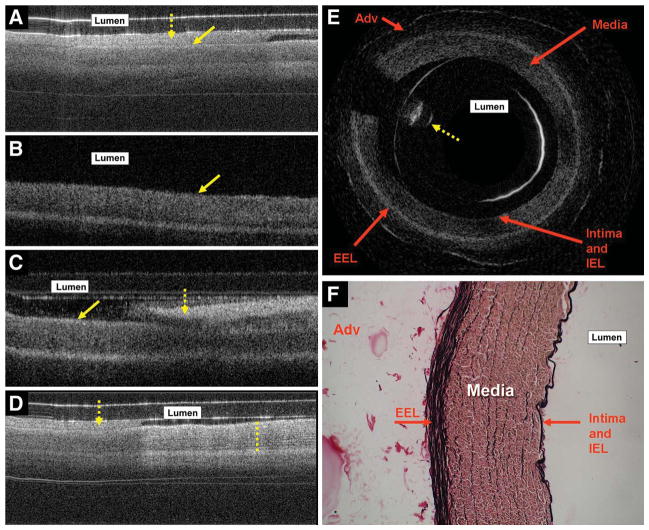 FIGURE 3