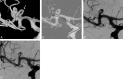 Fig 1.
