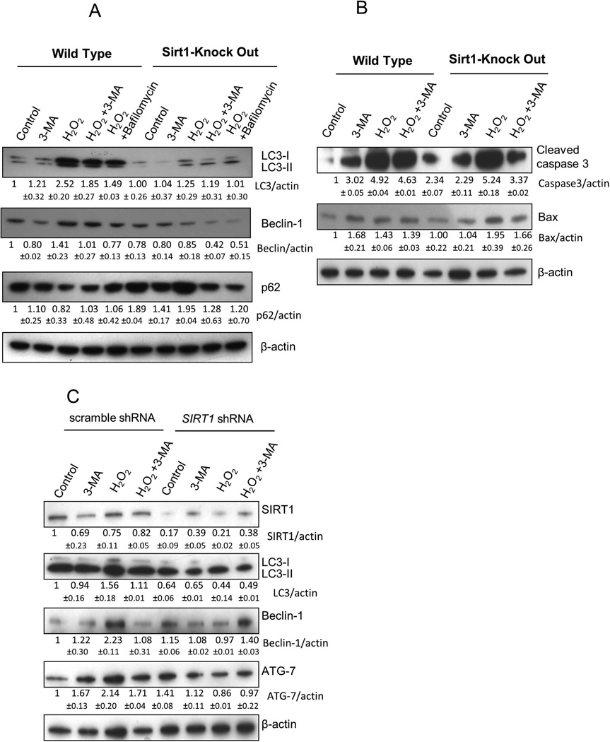 SIRT1 positively regulates autophagy and mitochondria function in ...