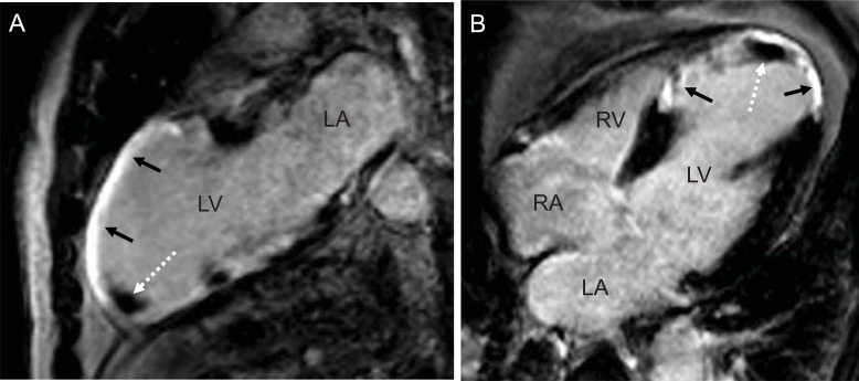 Fig. (1)