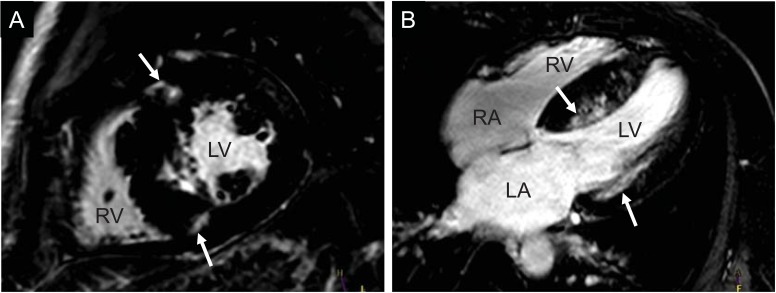 Fig. (2)