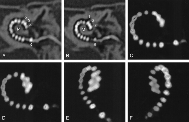 Fig 2.