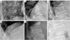 Figure 18