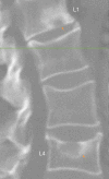 Figure 17
