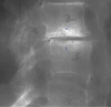 Figure 22