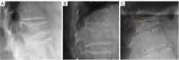 Figure 19