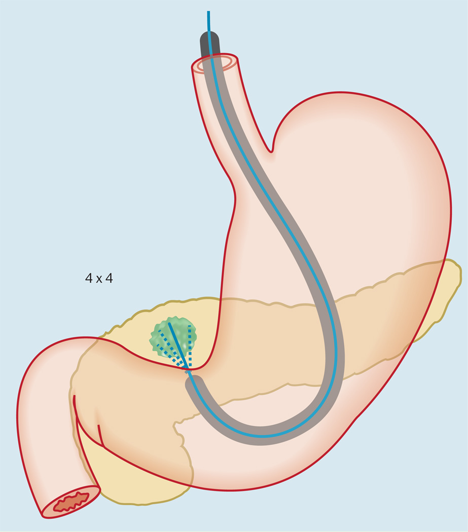 Fig.2