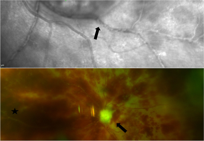 Fig. 2