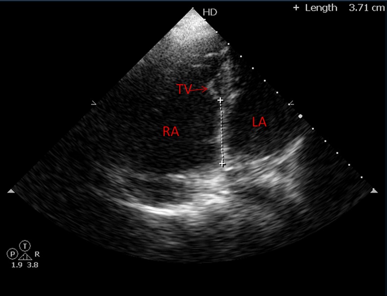 Figure 2