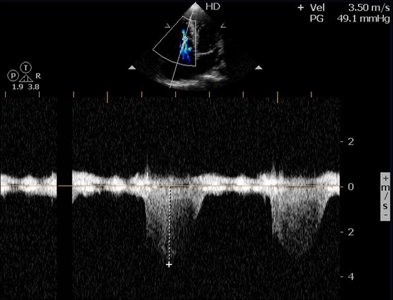 Figure 1