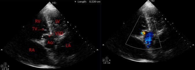 Figure 3