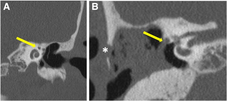 Fig. 9