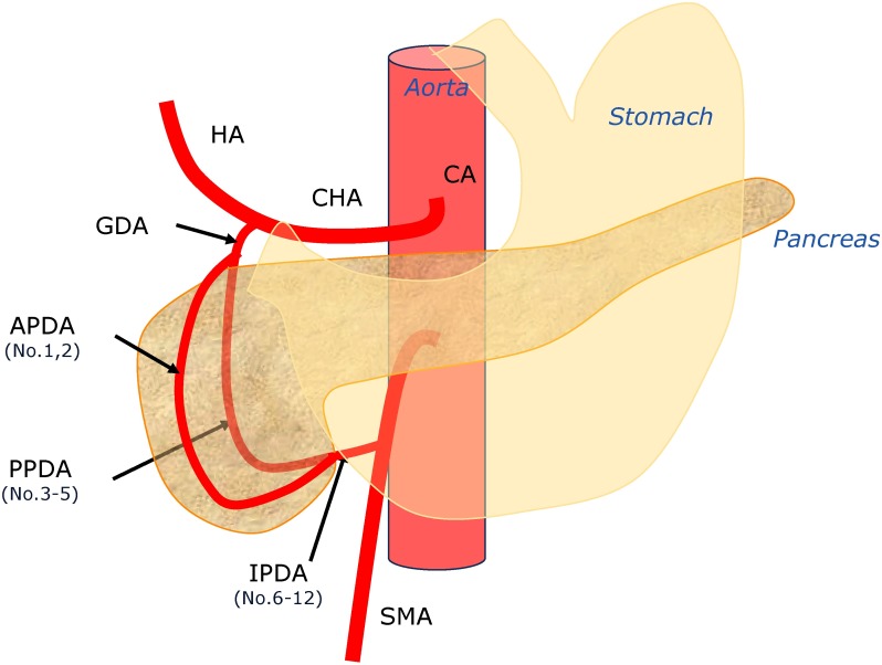 Fig. 1 Location of the posterior superior pancreaticoduodenal artery aneurysms.