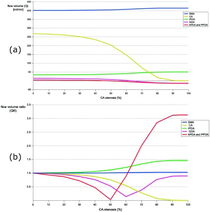 Fig. 3 (a) Change of the flow volume with the degree of celiac artery stenosis; (b) Change of the flow volume ratio with the degree of celiac artery stenosis.