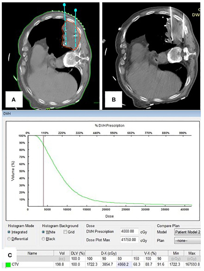 Figure 3