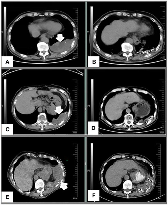 Figure 2