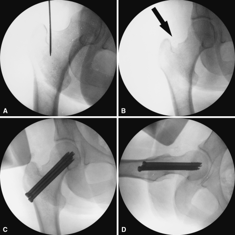 Fig. 6A–D