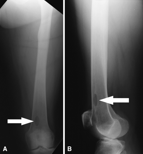 Fig. 5A–B