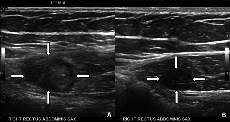 Fig. 4