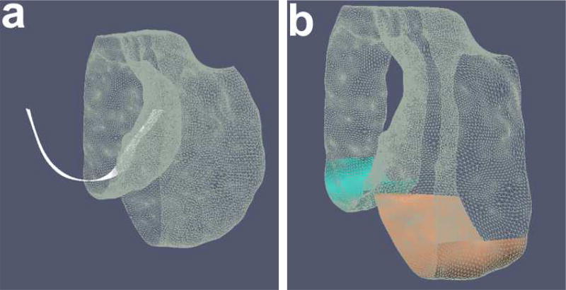 Fig. 11