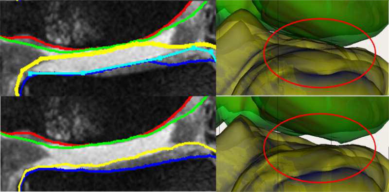 Fig. 9