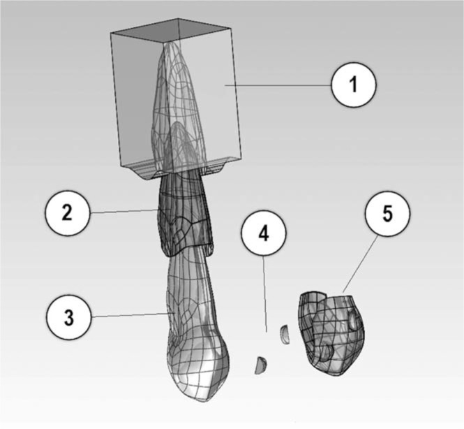 Figure 2. . CAD model assembly: (1) Alveolar bone, (2) Periodontal ligament, (3) Tooth, (4) Composite attachments, and (5) Plastic aligner.