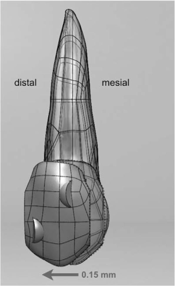 Figure 3. . The effect of one treatment stage (aligner) was simulated by distally displacing the aligner segment 0.15 mm in the FE model.