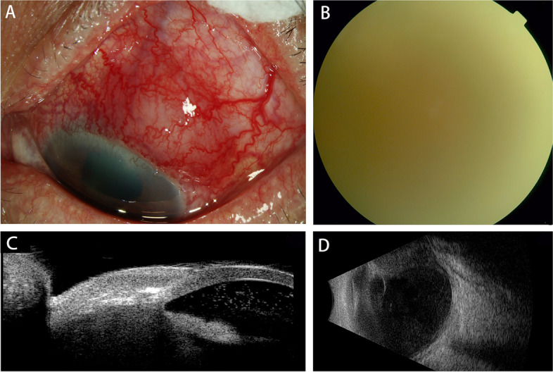 Fig. 1